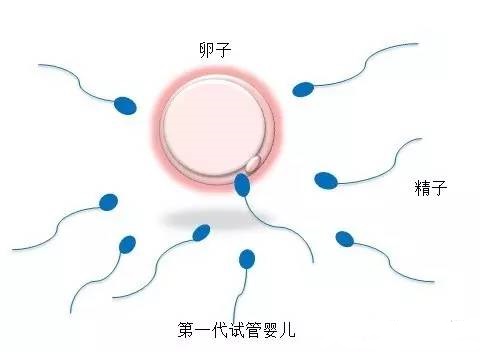 爱心供卵助孕咨询怎么收费